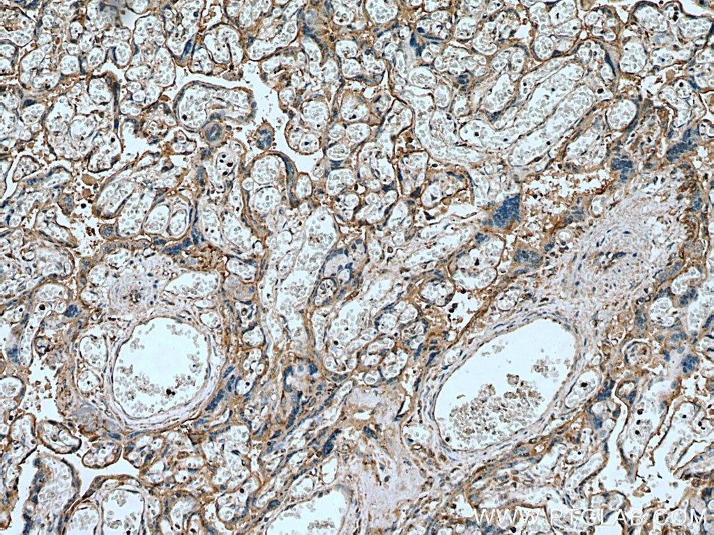 Immunohistochemistry (IHC) staining of human placenta tissue using Myoferlin Polyclonal antibody (19548-1-AP)