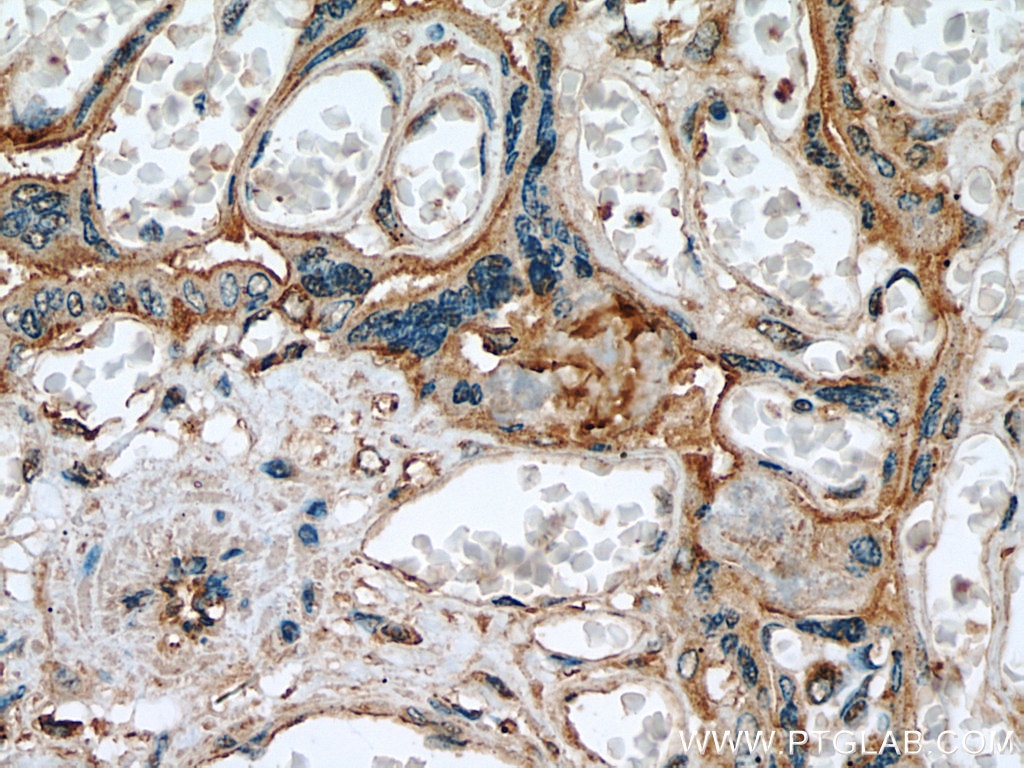 Immunohistochemistry (IHC) staining of human placenta tissue using Myoferlin Polyclonal antibody (19548-1-AP)