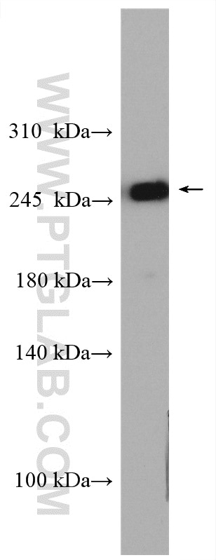 Western Blot (WB) analysis of human placenta tissue using Myoferlin Polyclonal antibody (19548-1-AP)