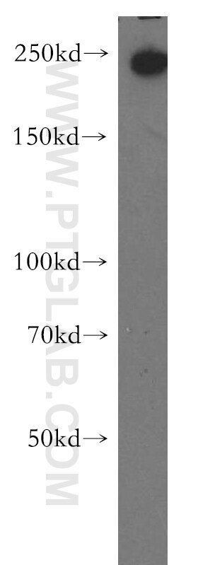 Western Blot (WB) analysis of A549 cells using Myoferlin Polyclonal antibody (19548-1-AP)