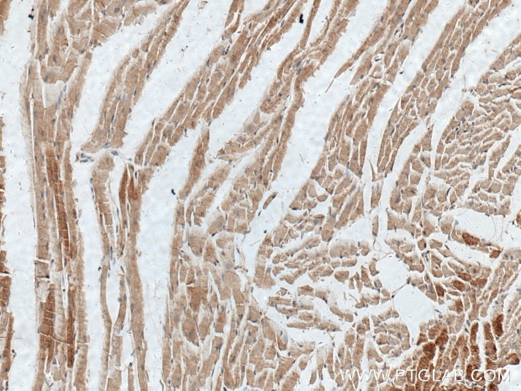 Immunohistochemistry (IHC) staining of mouse heart tissue using MYOM1 Polyclonal antibody (22084-1-AP)