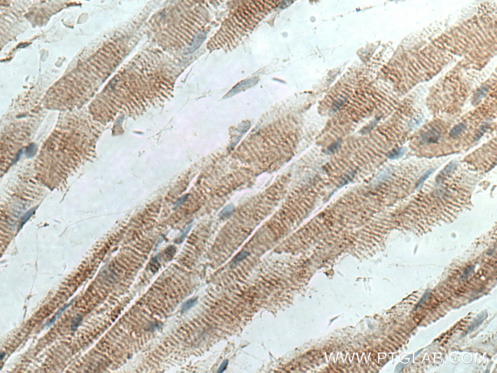 Immunohistochemistry (IHC) staining of mouse heart tissue using MYOM1 Polyclonal antibody (22084-1-AP)