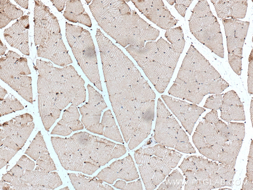 Immunohistochemistry (IHC) staining of mouse skeletal muscle tissue using MYOM1 Polyclonal antibody (22084-1-AP)