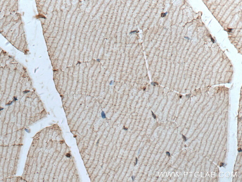 Immunohistochemistry (IHC) staining of mouse skeletal muscle tissue using MYOM1 Polyclonal antibody (22084-1-AP)