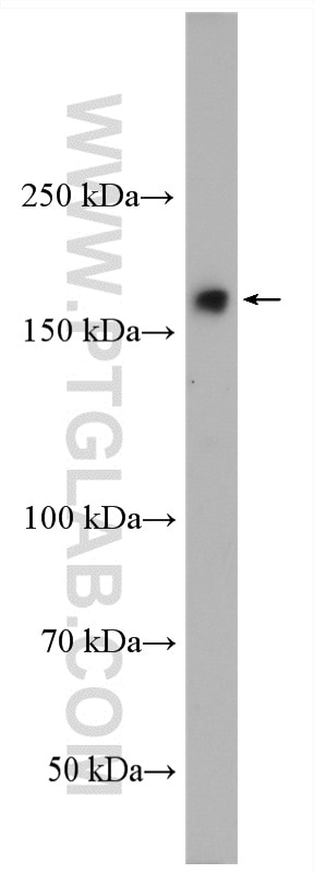 Western Blot (WB) analysis of rat heart tissue using MYOM1 Polyclonal antibody (22084-1-AP)