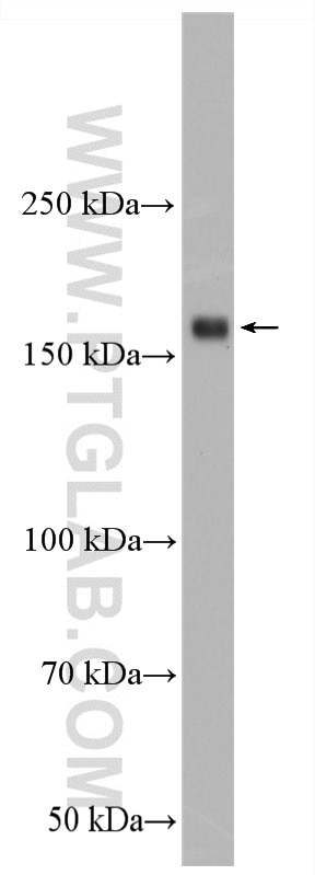 Western Blot (WB) analysis of mouse heart tissue using MYOM1 Polyclonal antibody (22084-1-AP)