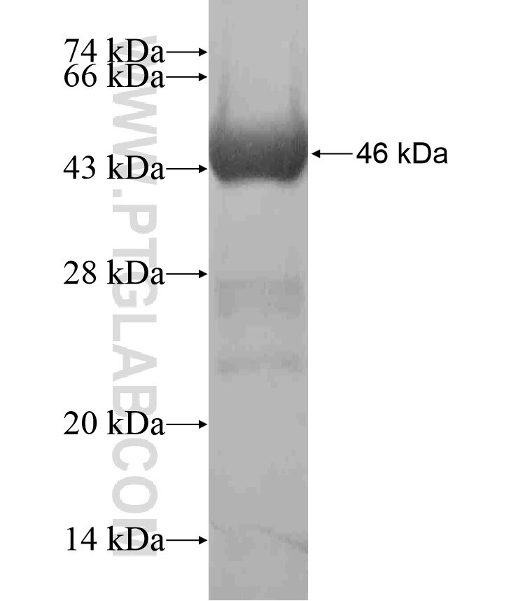 MYOM1 fusion protein Ag17259 SDS-PAGE