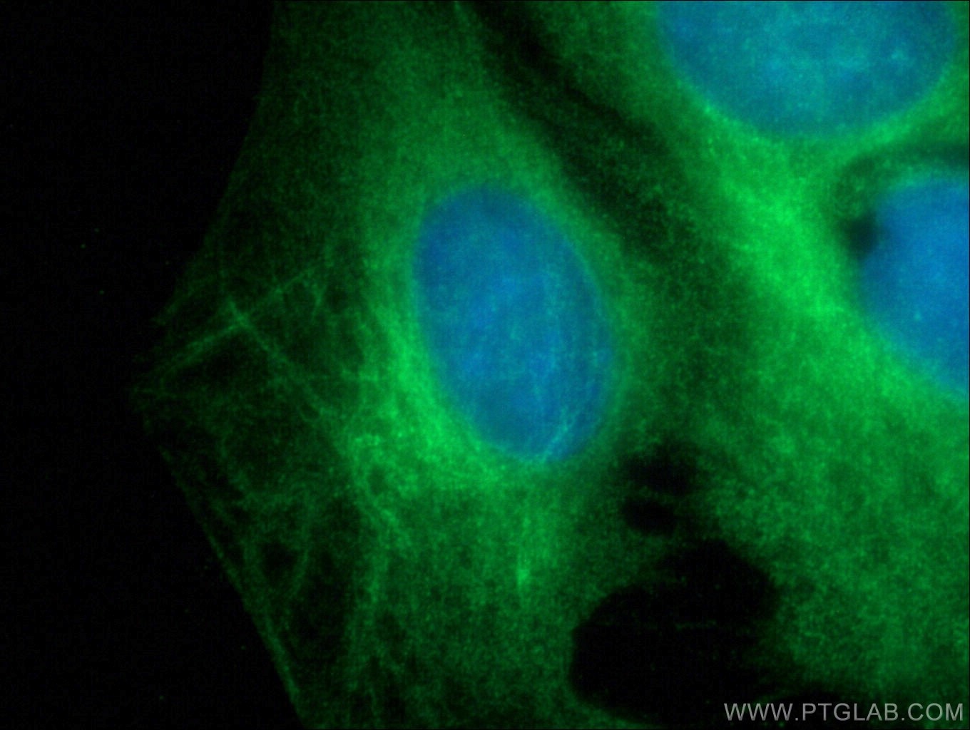 Immunofluorescence (IF) / fluorescent staining of C2C12 cells using MYOM1-Specific Polyclonal antibody (20360-1-AP)