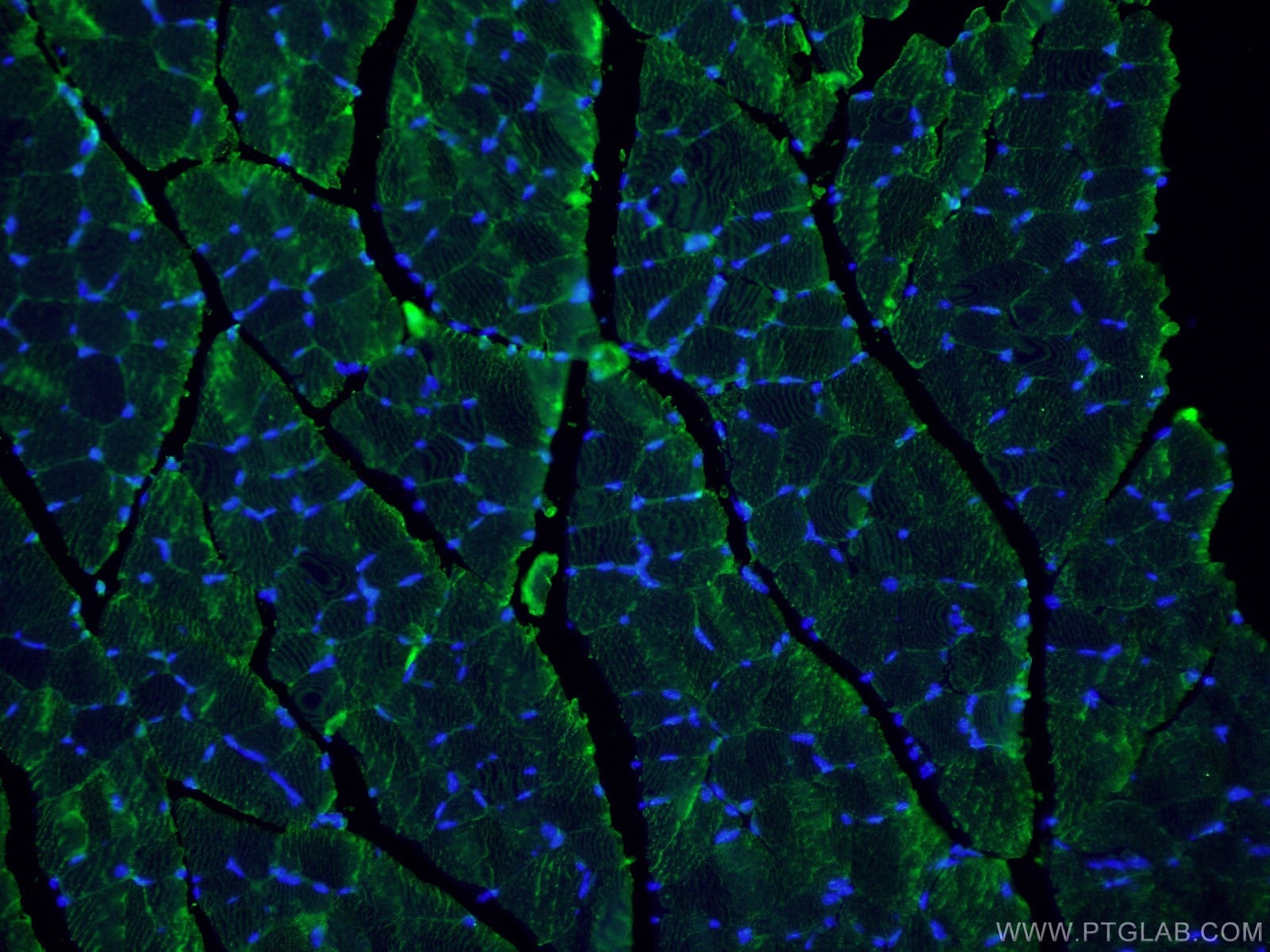 Immunofluorescence (IF) / fluorescent staining of mouse skeletal muscle tissue using MYOM1-Specific Polyclonal antibody (20360-1-AP)