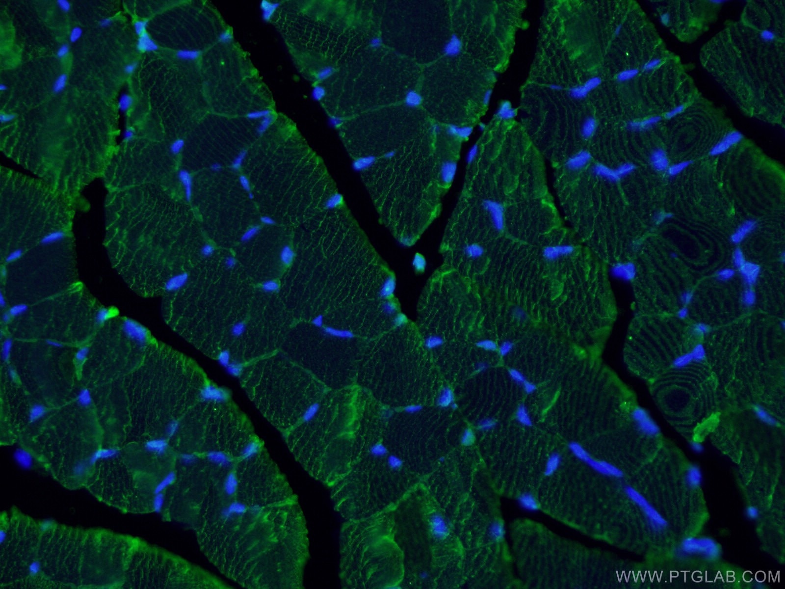 Immunofluorescence (IF) / fluorescent staining of mouse skeletal muscle tissue using MYOM1-Specific Polyclonal antibody (20360-1-AP)