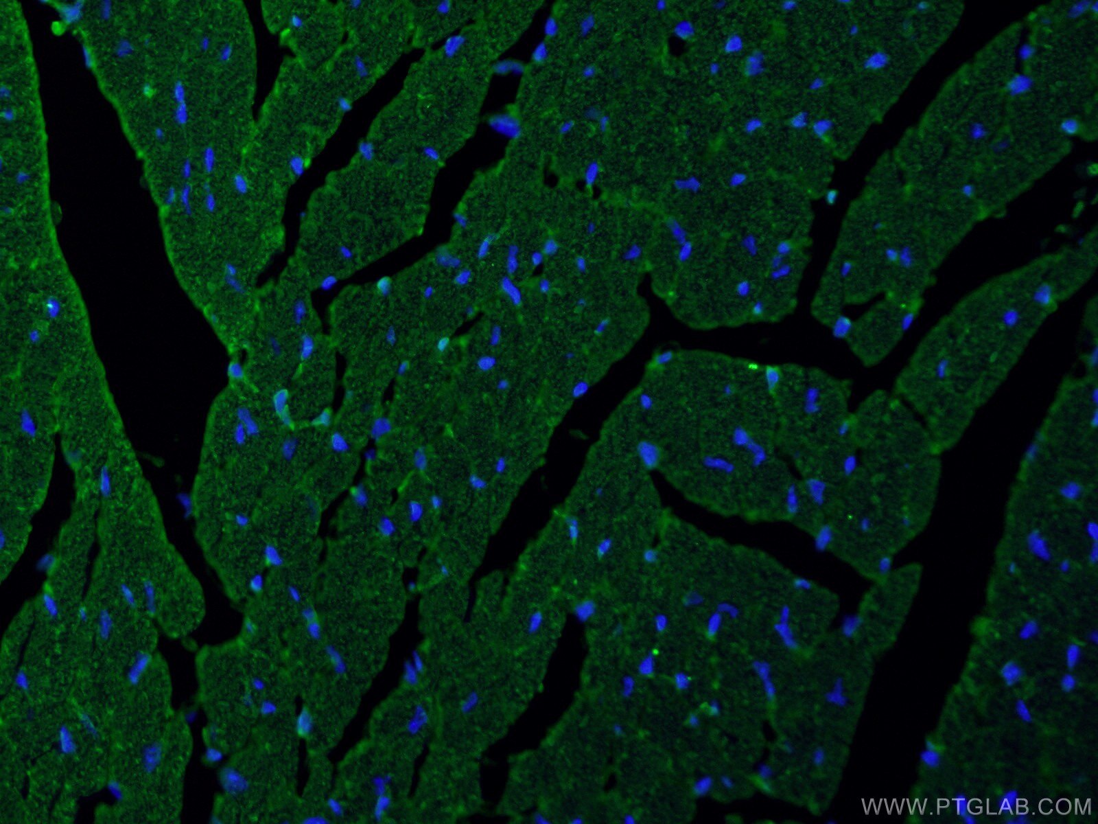 Immunofluorescence (IF) / fluorescent staining of mouse heart tissue using MYOM1-Specific Polyclonal antibody (20360-1-AP)