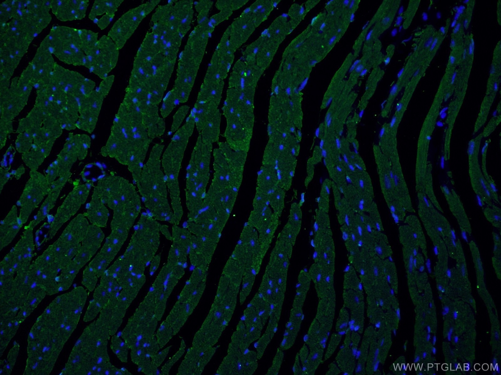 Immunofluorescence (IF) / fluorescent staining of mouse heart tissue using MYOM1-Specific Polyclonal antibody (20360-1-AP)