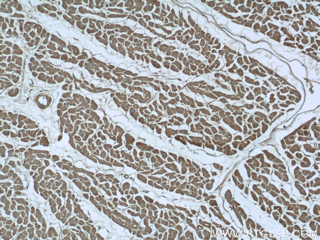 Immunohistochemistry (IHC) staining of human heart tissue using MYOM1-Specific Polyclonal antibody (20360-1-AP)