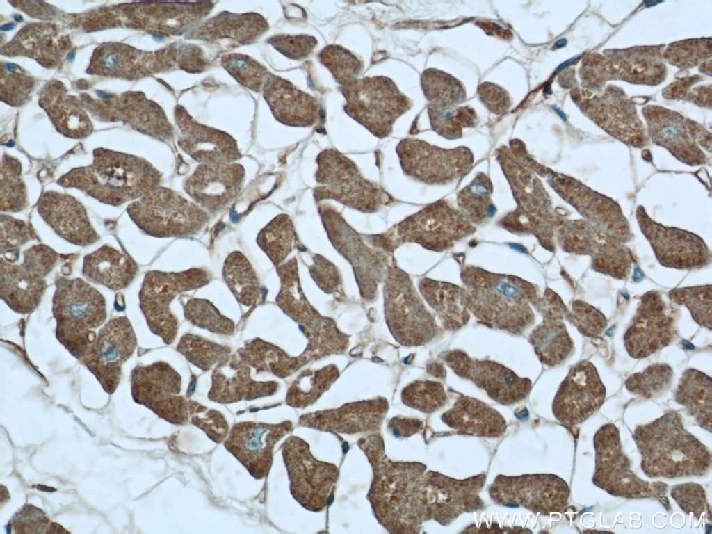 Immunohistochemistry (IHC) staining of human heart tissue using MYOM1-Specific Polyclonal antibody (20360-1-AP)