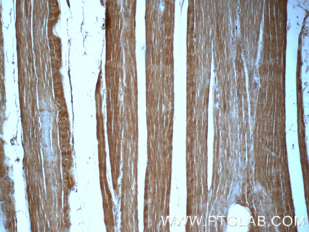 IHC staining of human skeletal muscle using 20360-1-AP