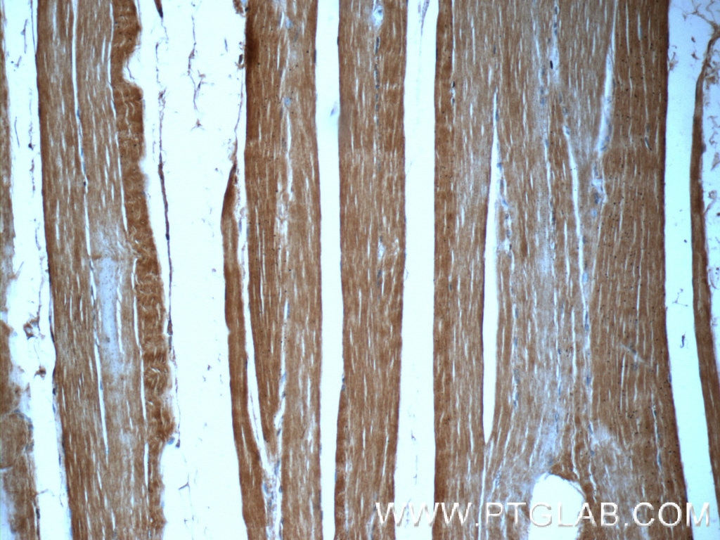 Immunohistochemistry (IHC) staining of human skeletal muscle tissue using MYOM1-Specific Polyclonal antibody (20360-1-AP)