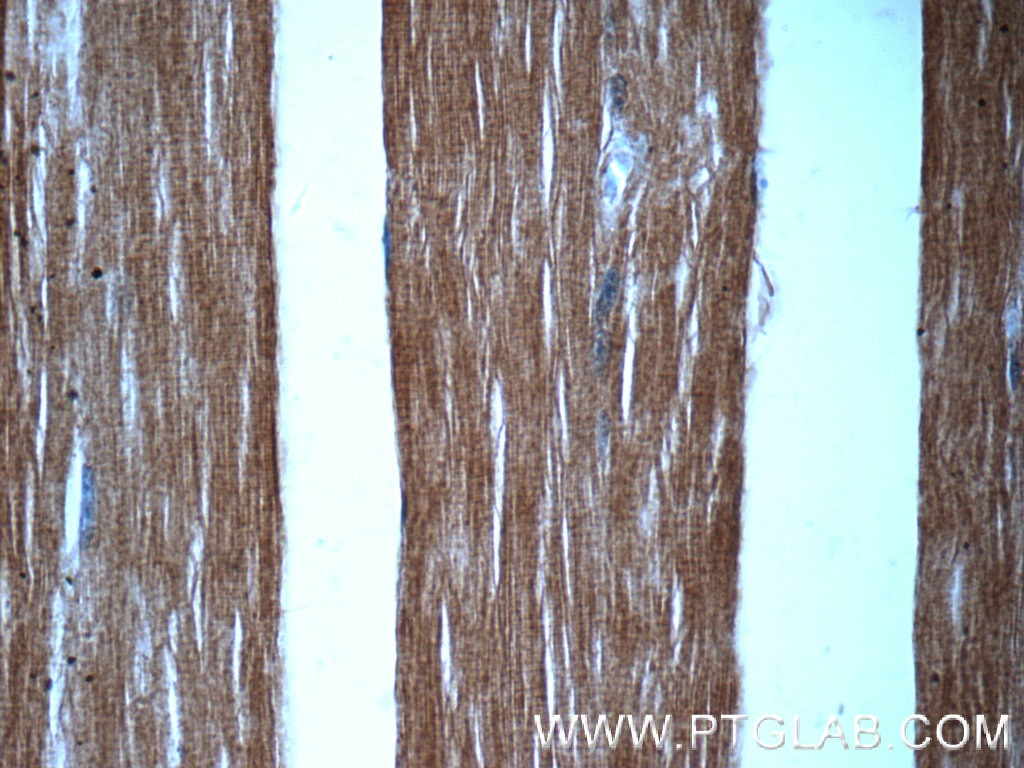 Immunohistochemistry (IHC) staining of human skeletal muscle tissue using MYOM1-Specific Polyclonal antibody (20360-1-AP)