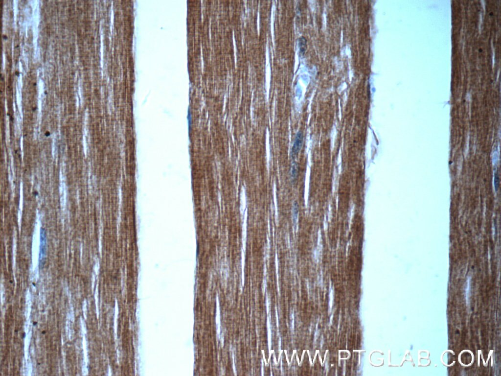 Immunohistochemistry (IHC) staining of human skeletal muscle tissue using MYOM1-Specific Polyclonal antibody (20360-1-AP)