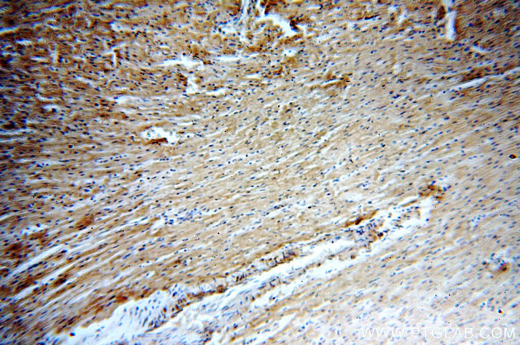 Immunohistochemistry (IHC) staining of human heart tissue using MYOM1-Specific Polyclonal antibody (20360-1-AP)