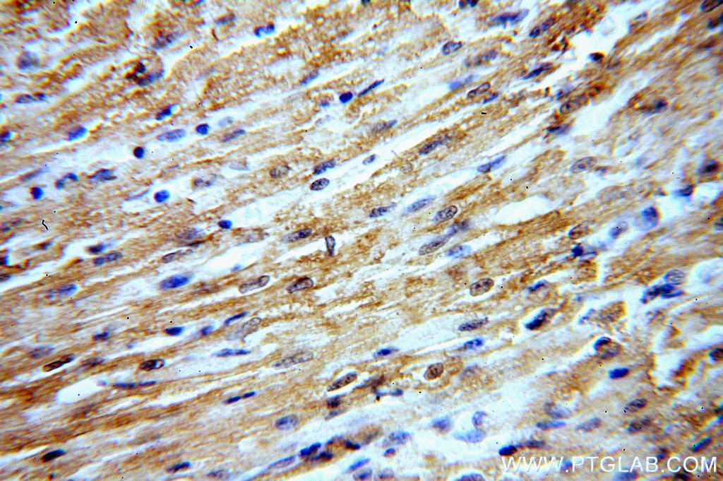 Immunohistochemistry (IHC) staining of human heart tissue using MYOM1-Specific Polyclonal antibody (20360-1-AP)