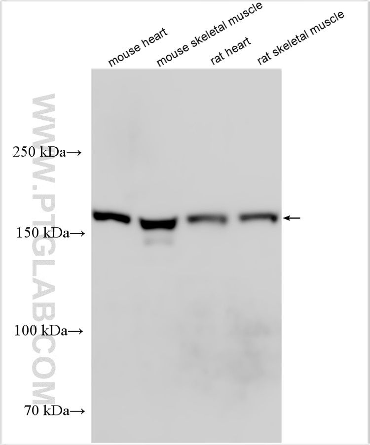 Western Blot (WB) analysis of various lysates using MYOM1-Specific Polyclonal antibody (20360-1-AP)
