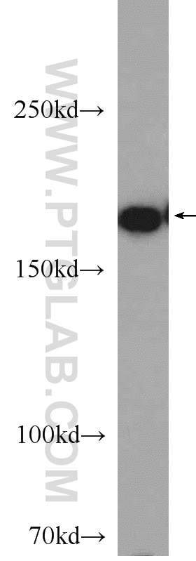 Western Blot (WB) analysis of mouse skeletal muscle tissue using MYOM1-Specific Polyclonal antibody (20360-1-AP)