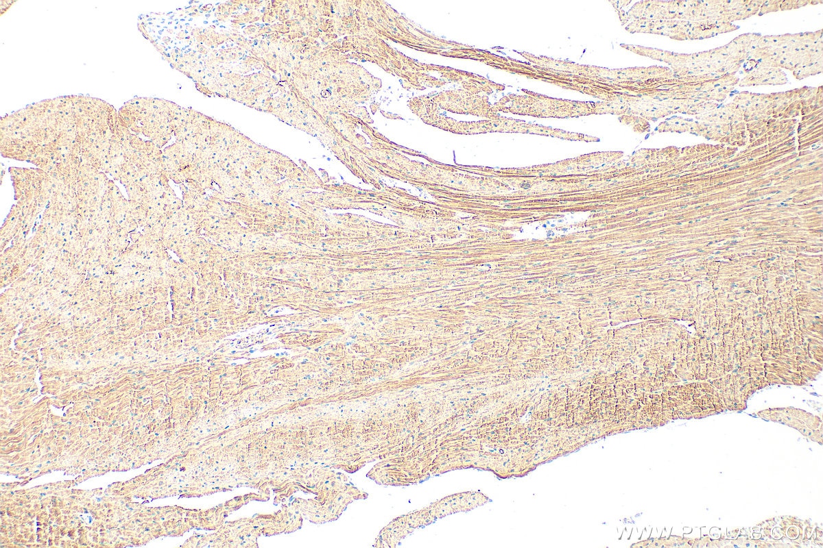 IHC staining of mouse heart using 32262-1-AP (same clone as 32262-1-PBS) Immunohistochemistry (IHC) staining of mouse heart tissue using MYOM2 Polyclonal antibody (32262-1-AP)