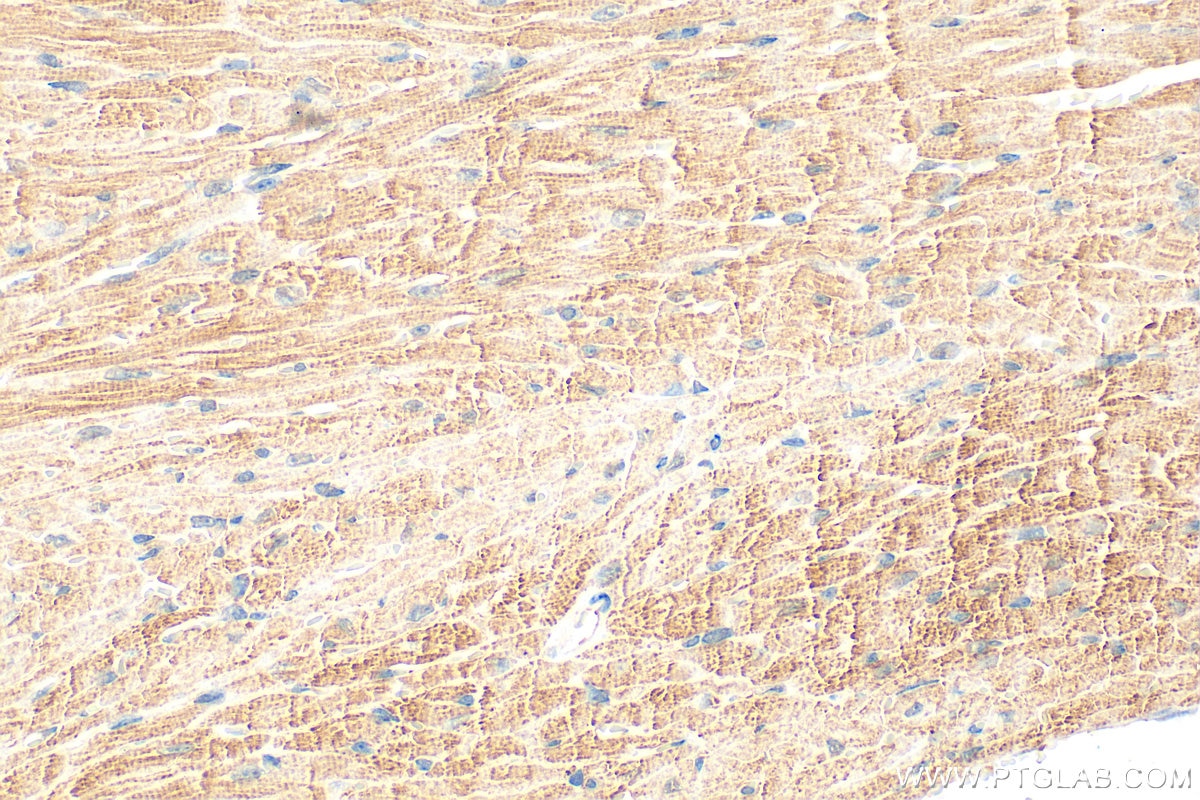 IHC staining of mouse heart using 32262-1-AP (same clone as 32262-1-PBS) Immunohistochemistry (IHC) staining of mouse heart tissue using MYOM2 Polyclonal antibody (32262-1-AP)