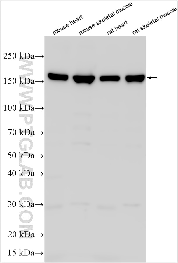 WB analysis using 32262-1-AP (same clone as 32262-1-PBS) Western Blot (WB) analysis of various lysates using MYOM2 Polyclonal antibody (32262-1-AP)