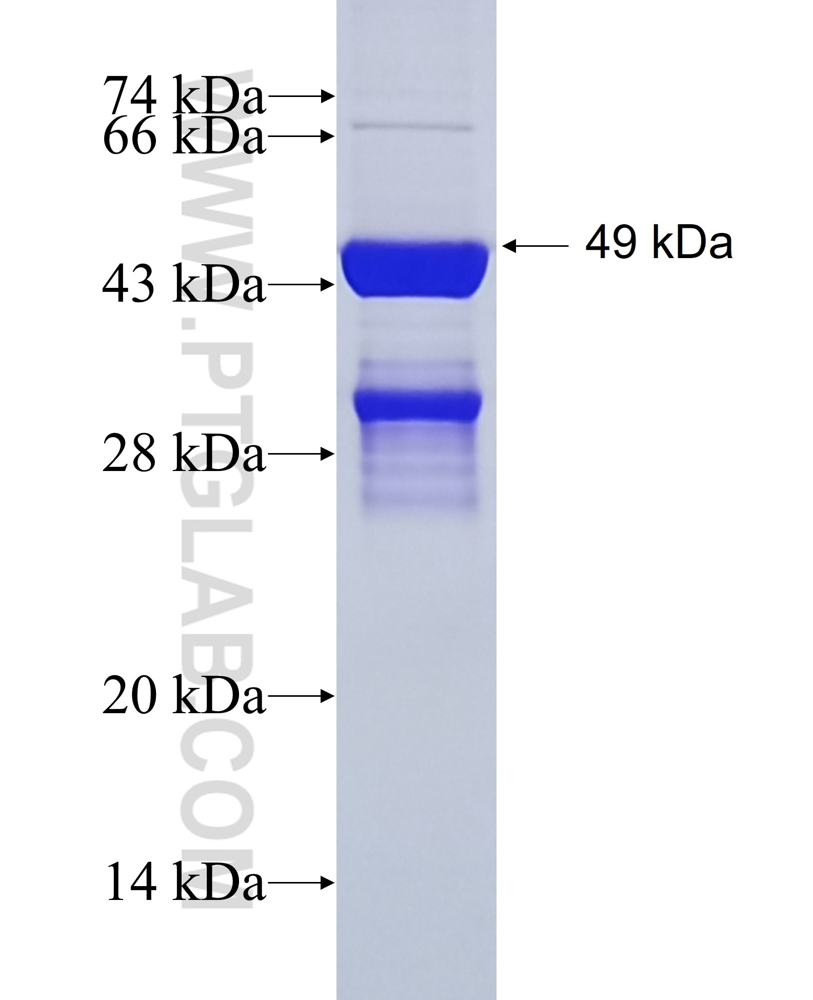 MYOM2 fusion protein Ag35659 SDS-PAGE