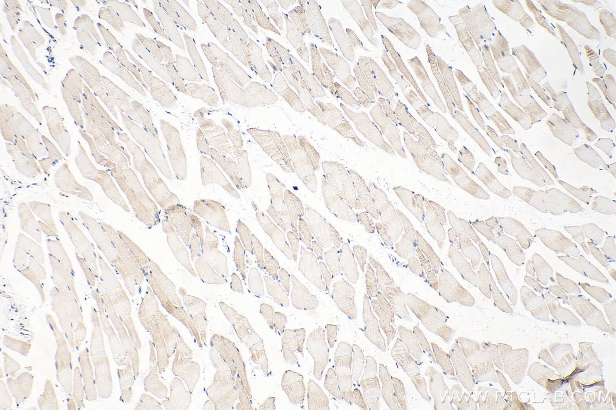 Immunohistochemistry (IHC) staining of mouse skeletal muscle tissue using MYOM3 Polyclonal antibody (17692-1-AP)