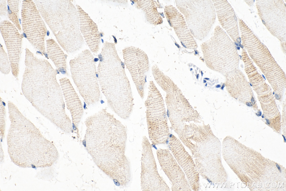 Immunohistochemistry (IHC) staining of mouse skeletal muscle tissue using MYOM3 Polyclonal antibody (17692-1-AP)