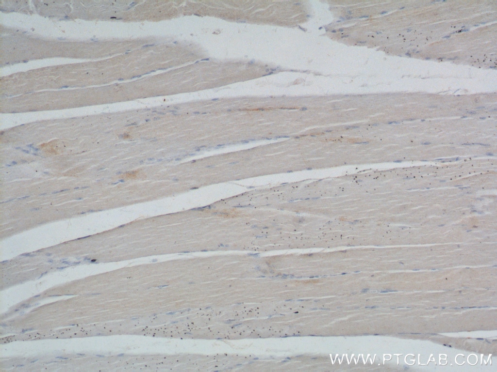 IHC staining of human skeletal muscle using 17692-1-AP