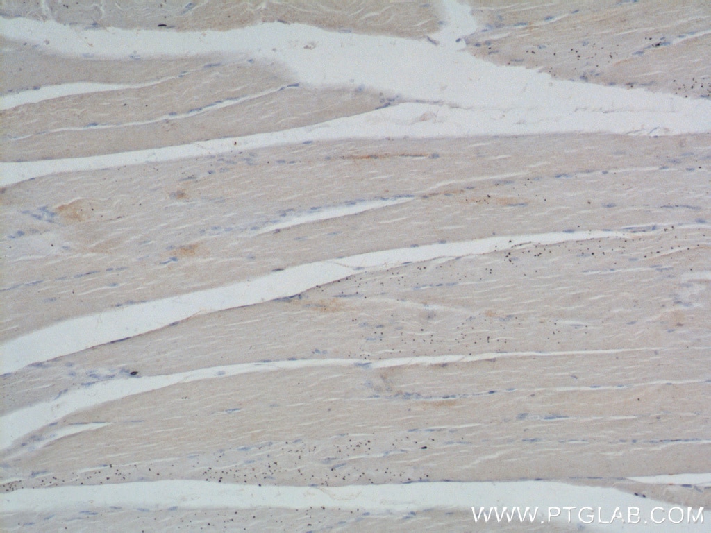 Immunohistochemistry (IHC) staining of human skeletal muscle tissue using MYOM3 Polyclonal antibody (17692-1-AP)