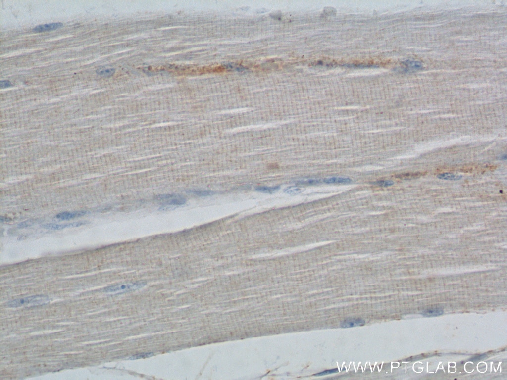 IHC staining of human skeletal muscle using 17692-1-AP