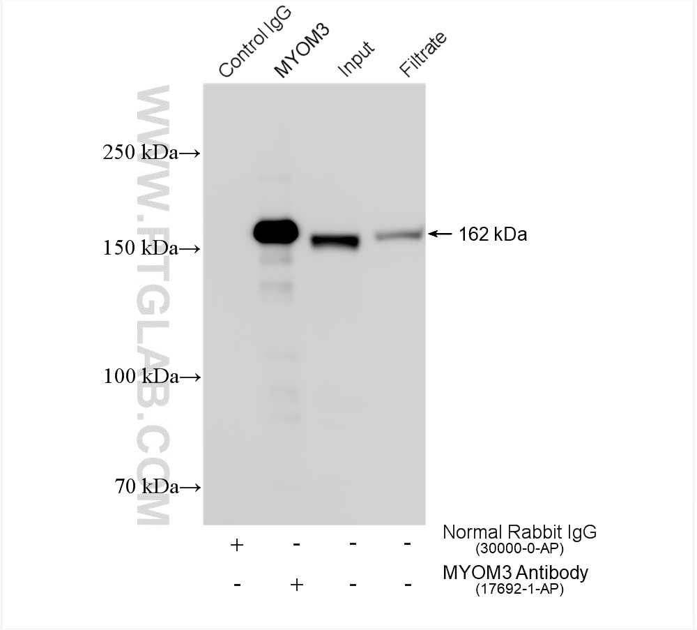 Immunoprecipitation (IP) experiment of mouse skeletal muscle tissue using MYOM3 Polyclonal antibody (17692-1-AP)