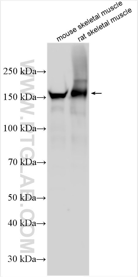 Western Blot (WB) analysis of various lysates using MYOM3 Polyclonal antibody (17692-1-AP)