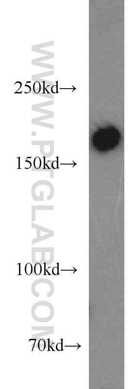 Western Blot (WB) analysis of mouse skeletal muscle tissue using MYOM3 Polyclonal antibody (17692-1-AP)