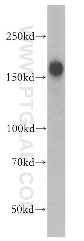 Western Blot (WB) analysis of mouse skeletal muscle tissue using MYOM3 Polyclonal antibody (17692-1-AP)