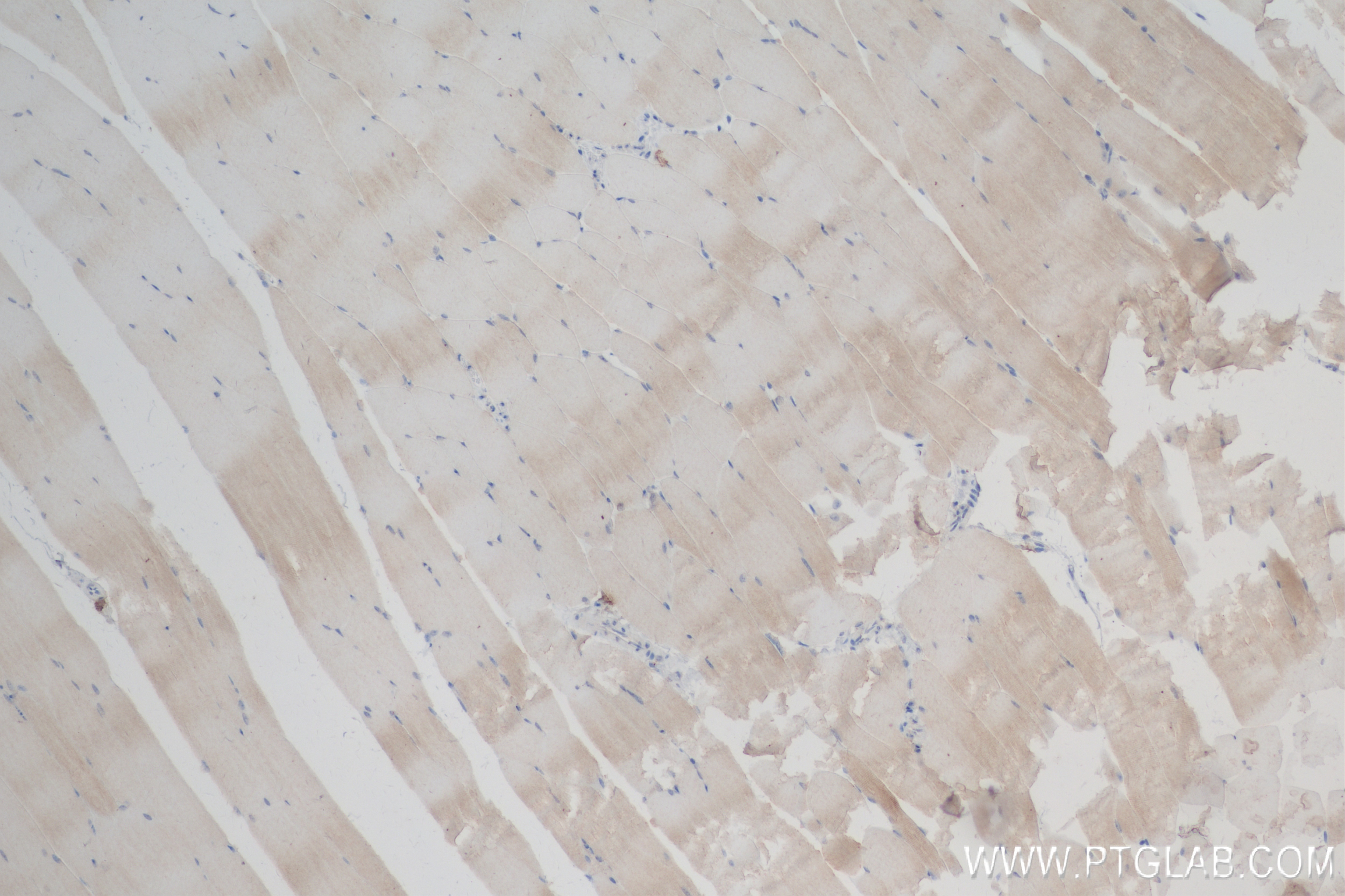 Immunohistochemistry (IHC) staining of mouse skeletal muscle tissue using MYOM3 Recombinant antibody (83852-3-RR)
