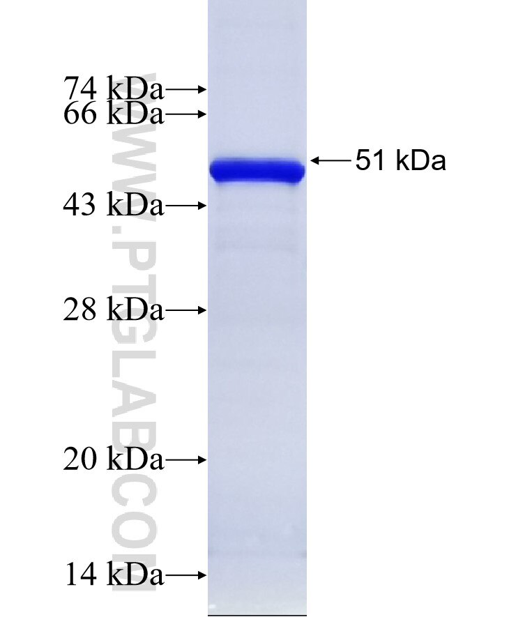 MYOM3 fusion protein Ag11849 SDS-PAGE