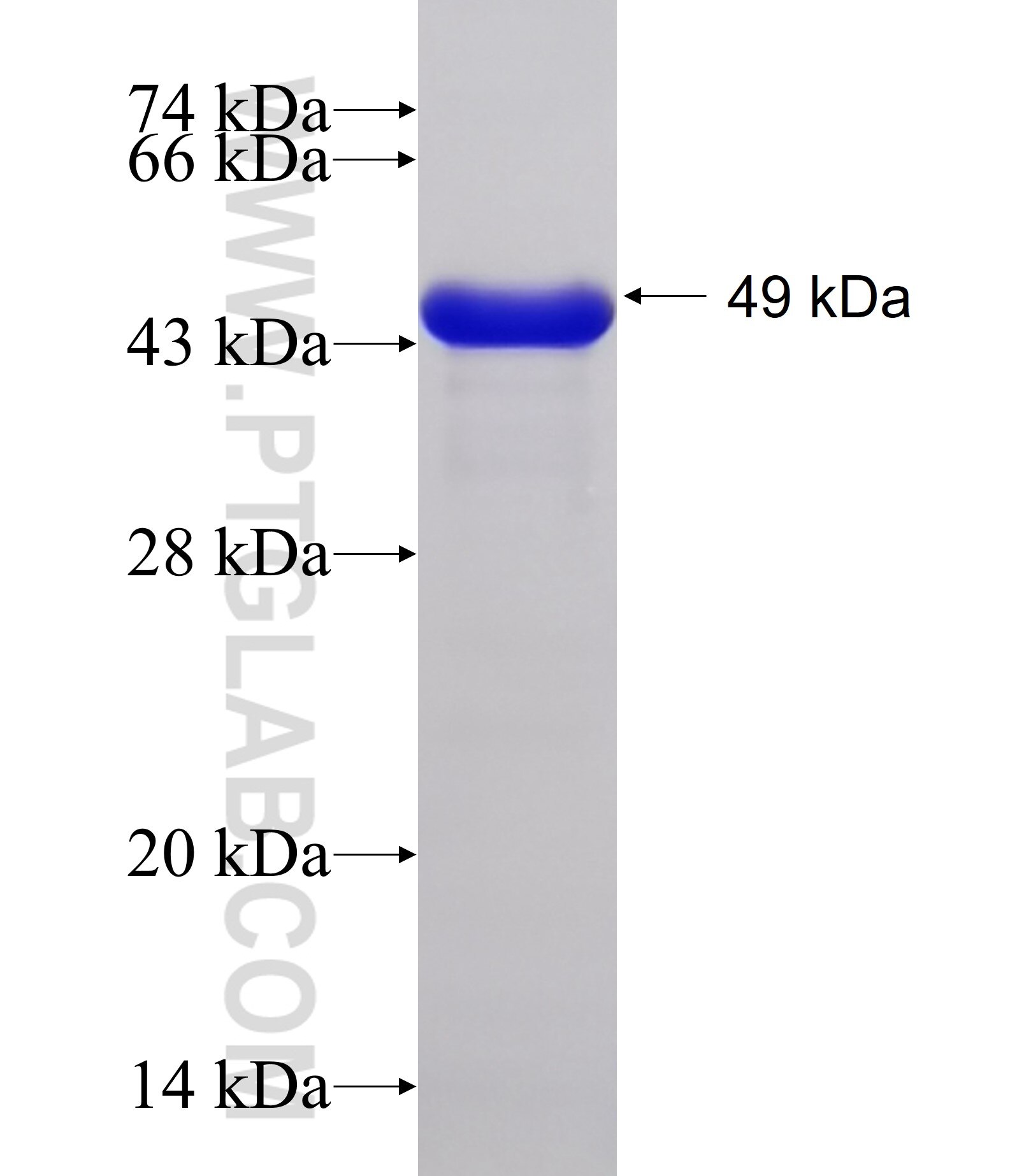 MYOM3 fusion protein Ag11849 SDS-PAGE