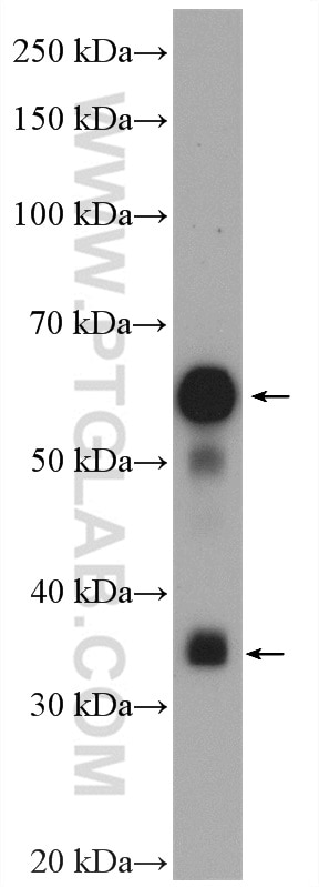 Western Blot (WB) analysis of mouse skeletal muscle tissue using MYOT Polyclonal antibody (10731-1-AP)