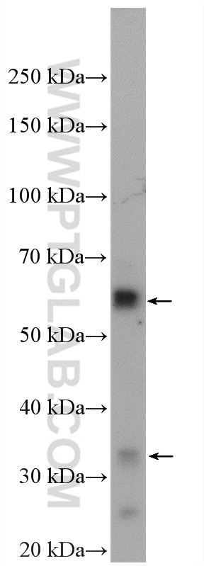 Western Blot (WB) analysis of mouse heart tissue using MYOT Polyclonal antibody (10731-1-AP)