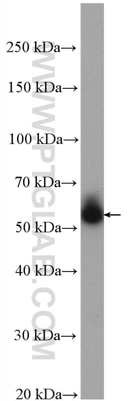 WB analysis of mouse skeletal muscle using 10731-1-AP