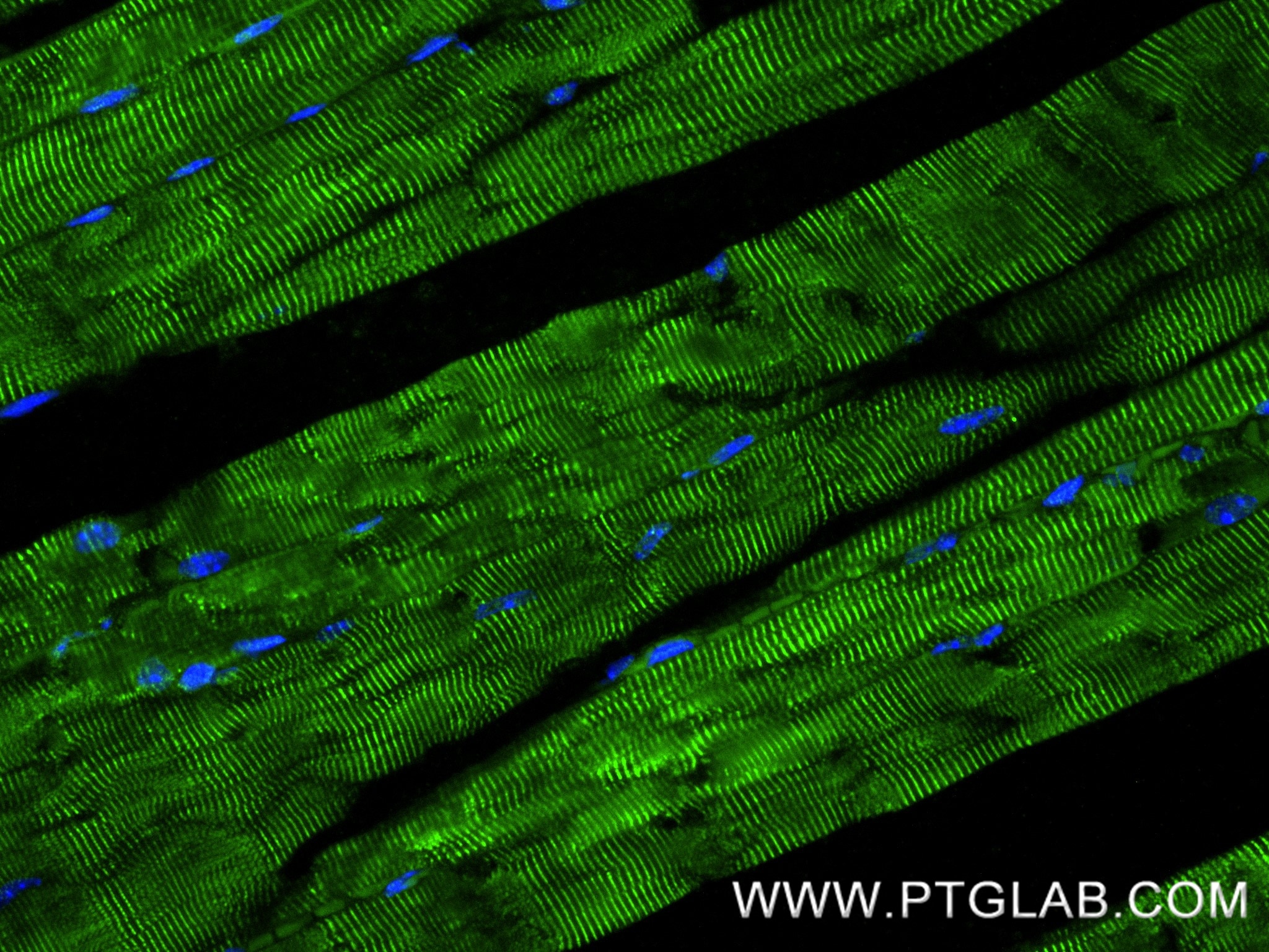 Immunofluorescence (IF) / fluorescent staining of mouse skeletal muscle tissue using MYOT Recombinant monoclonal antibody (87334-1-RR)