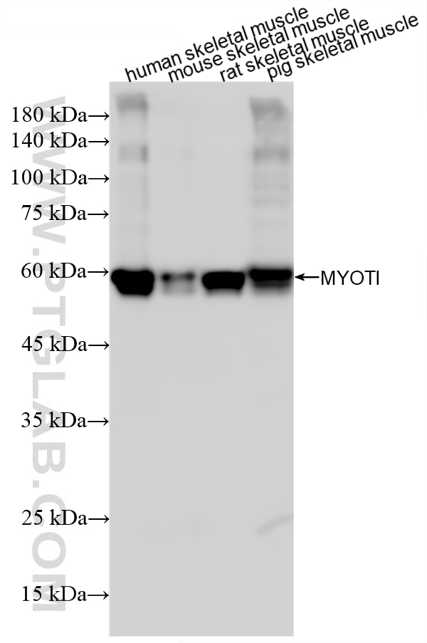 WB analysis using 87334-1-RR Western Blot (WB) analysis of various lysates using MYOTI Recombinant monoclonal antibody (87334-1-RR)