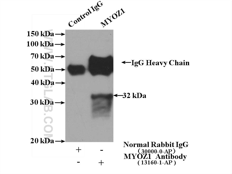 Immunoprecipitation (IP) experiment of mouse skeletal muscle tissue using MYOZ1 Polyclonal antibody (13160-1-AP)