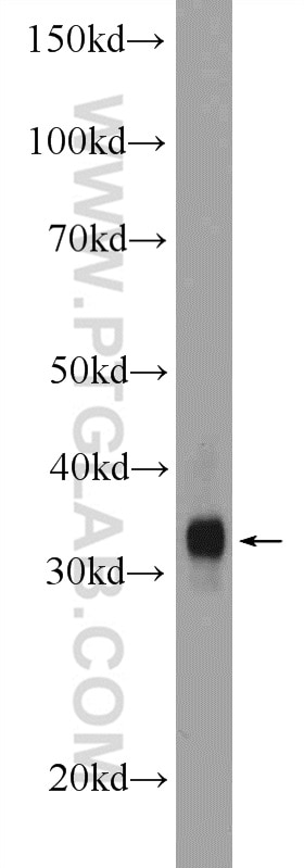 Western Blot (WB) analysis of mouse skeletal muscle tissue using MYOZ1 Polyclonal antibody (13160-1-AP)