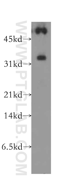 WB analysis of human heart using 13160-1-AP